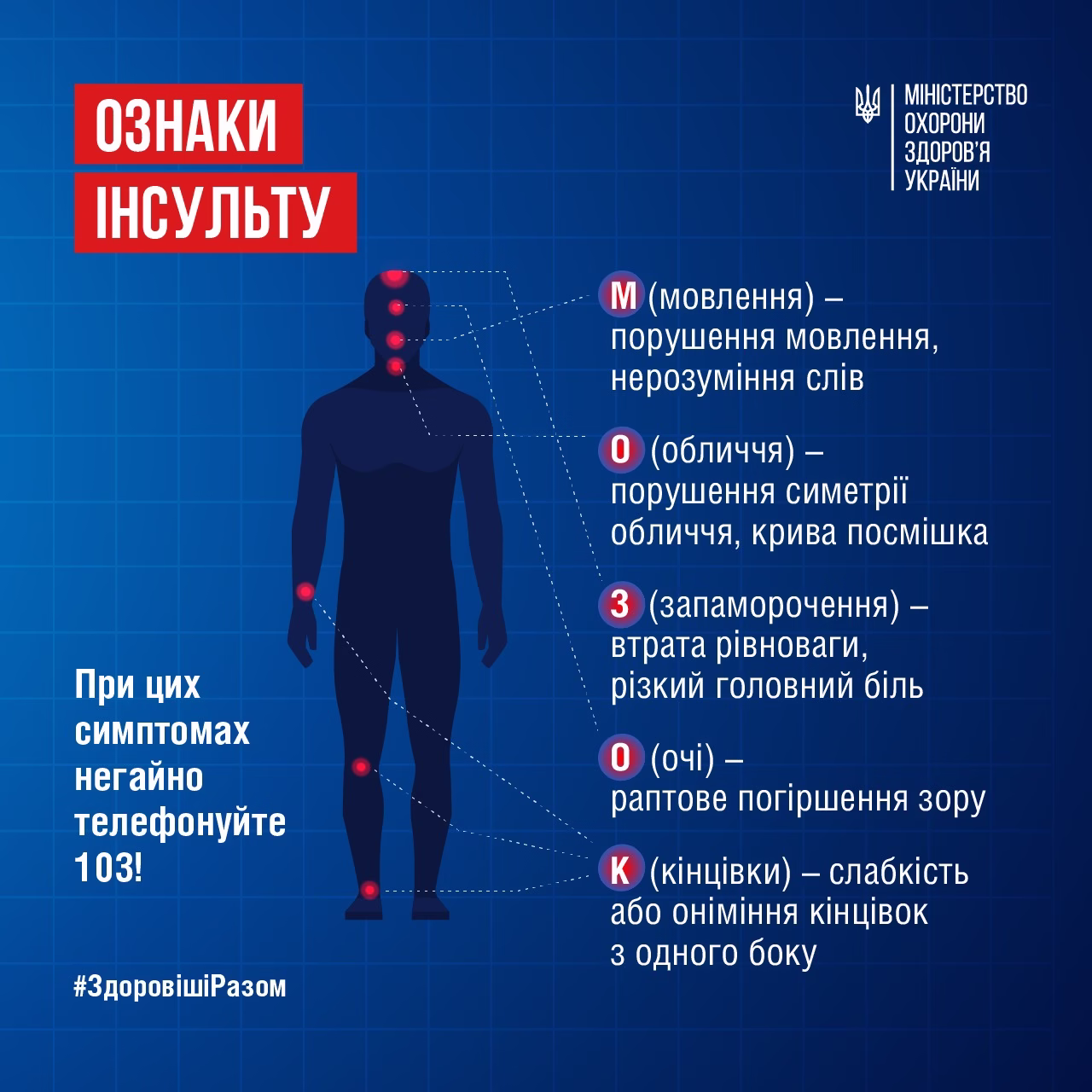 Ознаки інсульту за алгоритмом МОЗОК